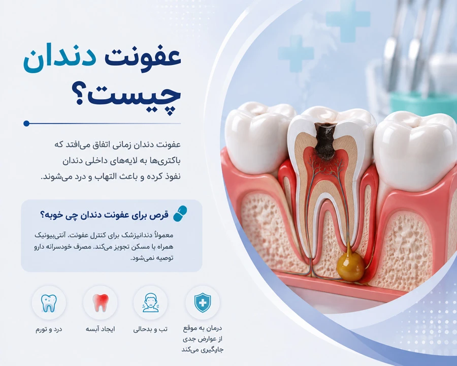 عفونت دندان چیست؟ و قرص برای عفونت دندان چی خوبه؟