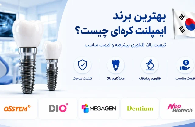 بهترین برند ایمپلنت کره ای چیست؟